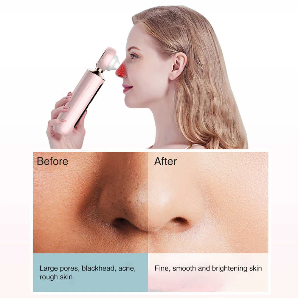 Modella™ Blackhead Suction Machine