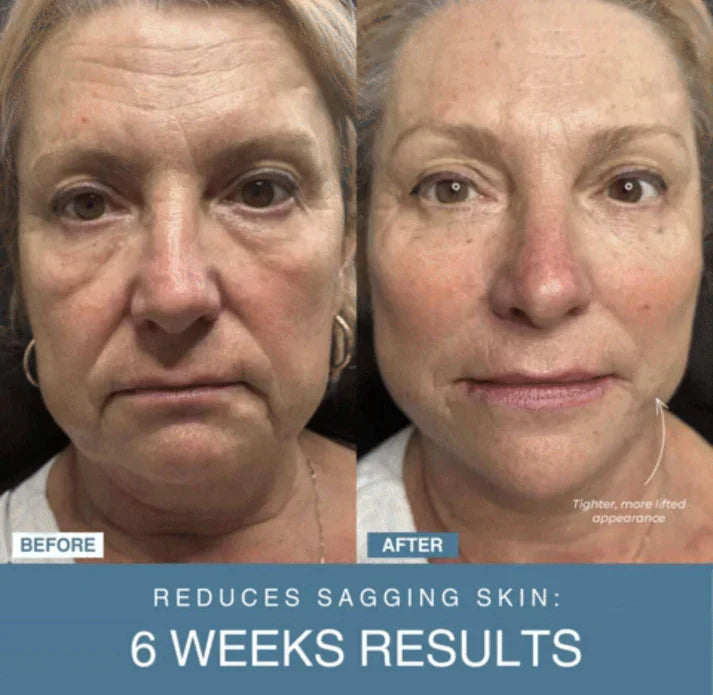 Modella™ 7-in-1 LED Anti-Aging/Wrinkle Apparatus