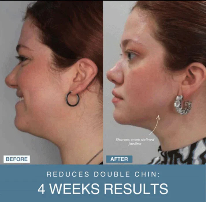 Modella™ 7-in-1 LED Anti-Aging/Wrinkle Apparatus