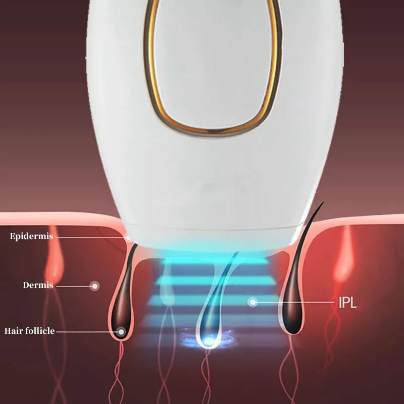 Modella™ IPL Laser Hair Removal – جهاز إزالة الشعر بالليزر IPL